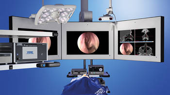耳鼻喉科光学导航系统