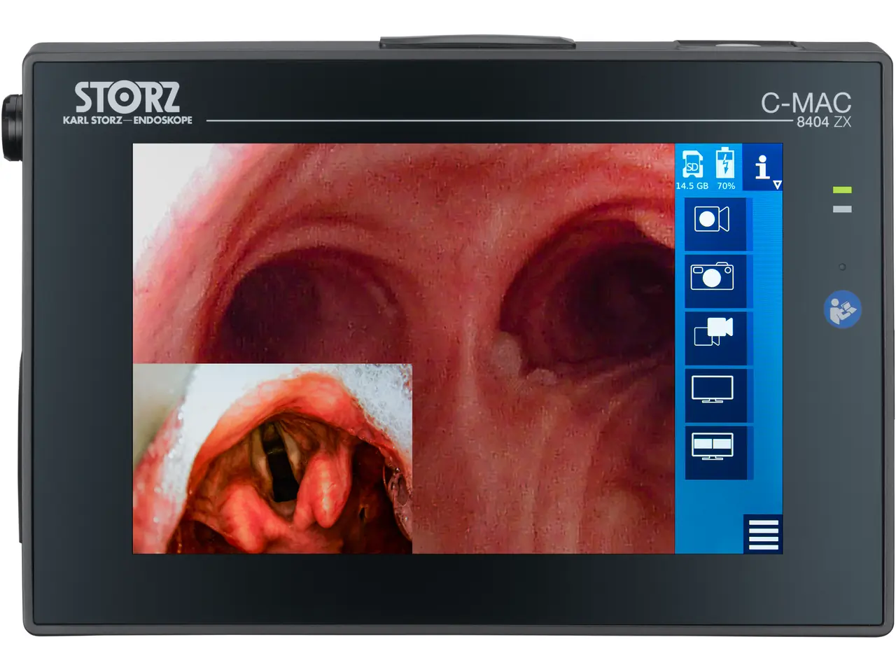 その他 Mac  LED  Display C-MAC Monitor for CMOS Endoscopes, Set | KARL STORZ Endoskope