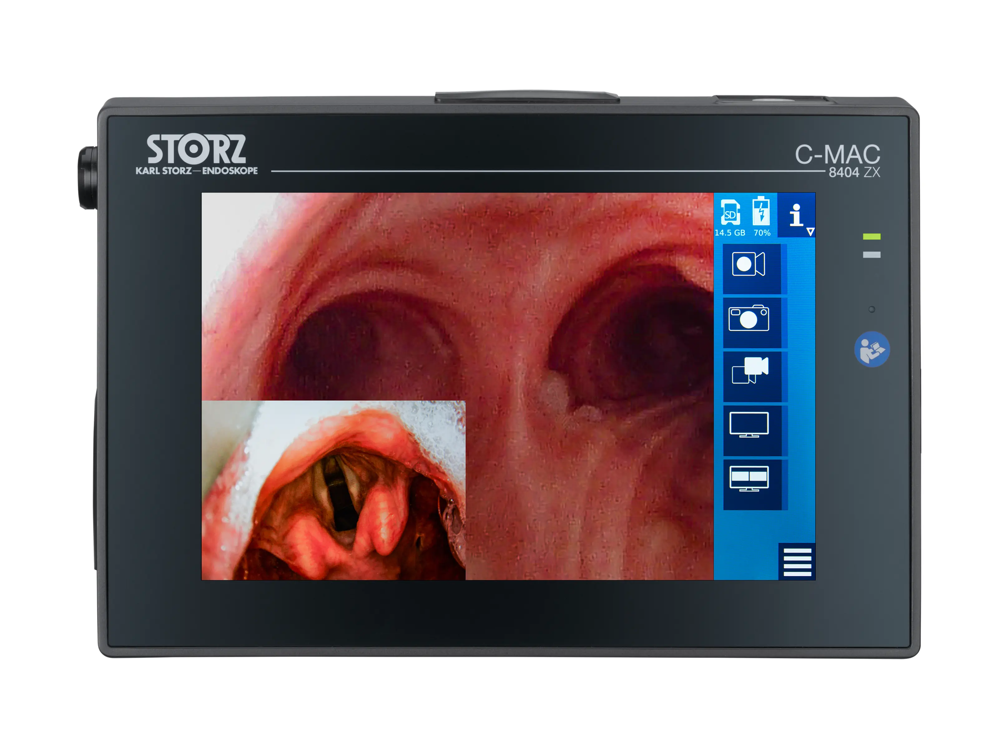 C-MAC Monitor for CMOS Endoscopes, Set | KARL STORZ Endoskope | 日本