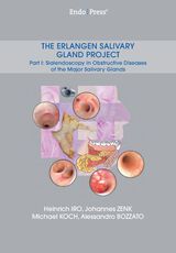 The Erlangen Salivary Gland Project – Part I: Sialendoscopy in Obstructive Diseases of the Major Salivary Glands