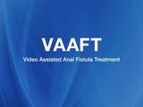 VAAFT – Video Assisted Anal Fistula Treatment