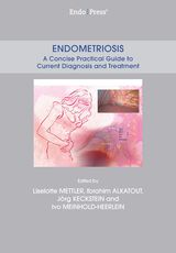 Endometriosis – A Concise Practical Guide to Current Diagnosis and Treatment