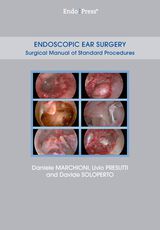 Endoscopic Ear Surgery – Surgical Manual of Standard Procedures