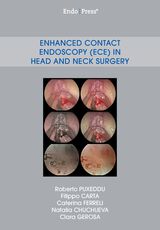 Enhanced Contact Endoscopy (ECE) in Head and Neck Surgery