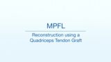 MPFL – Reconstruction using a Quadriceps Tendon Graft