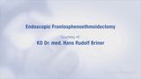 Endoscopic Frontosphenoethmoidectomy