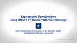Laparoscopic Sigmoidectomy using IMAGE1 S™ Rubina™ NIR/ICG Technology – Ureter Visualization, Determination of Resection Height and Abdominal Perfusion Assessment
