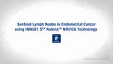 Shortclip – Sentinel Lymph Nodes in Endometrial Cancer using IMAGE 1 S™ Rubina™ NIR/ICG Technology