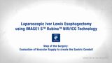 Laparoscopic Ivor Lewis Esophagectomy using IMAGE1 S™ Rubina™ NIR/ICG Technologye