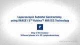 Laparoscopic Subtotal Gastrectomy using IMAGE1 S™ Rubina™ NIR/ICG Technology