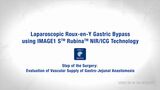 Laparoscopic Roux-en-Y Gastric Bypass using IMAGE1 S™ Rubina™ NIR/ICG Technology