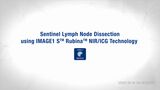 Sentinel Lymp Node Dissection using IMAGE1 S™ Rubina™ NIR/ICG Technology