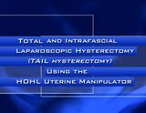 Total Atraumatic and Intrafascial Laparoscopic Hysterectomy (Tail Hysterectomy) using the HOHL Uterine Manipulator