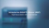 Intrauterine BIGATTI Shaver (IBS®) with Endomat®