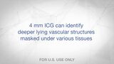 The Value of ONE – 4 mm ICG can identify deeper lying vascular structures masked under various tissues