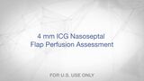 The Value of ONE – 4 mm ICG Nasoseptal Flap Perfusion Assessment