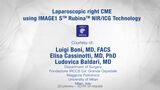 Laparoscopic right CME  in 3D with Fluorescence Angiography using IMAGE1 S™ Rubina™ NIR/ICG Technology