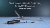In-Service: Fistuloscope – Handle Positioning for VAAFT Procedure