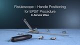 In-Service: Fistuloscope – Handle Positioning for EPSiT Procedure