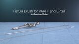 In-Service: Fistula Brush for VAAFT and EPSiT