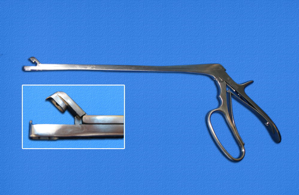 Secondary Prevention of Cervical Cancer