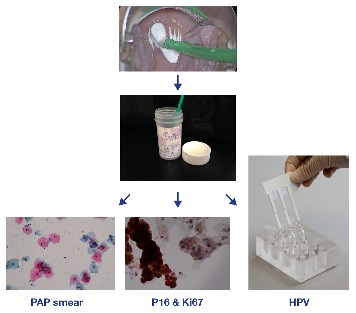 Liquid Based Cytology