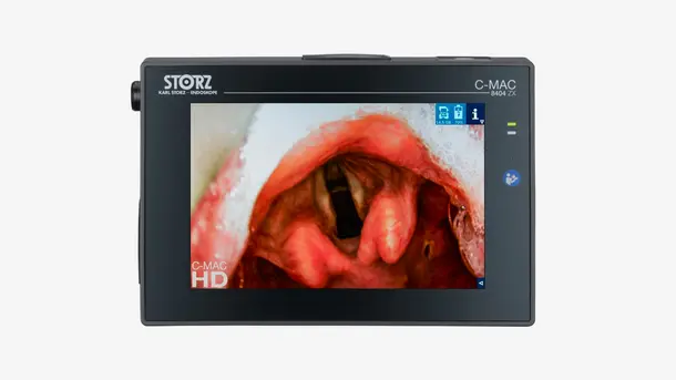 Larynx viewed on a C-MAC video laryngoscope monitor.