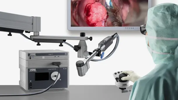 Surgeon operating medical endoscopy system while viewing an internal organ on a monitor.