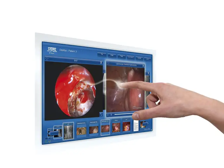 The KARL STORZ touchless gesture control system MI Report awarded in the "Land of Ideas" contest.