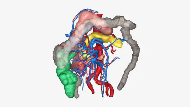 3D medical illustration of abdominal vessels and organs.
