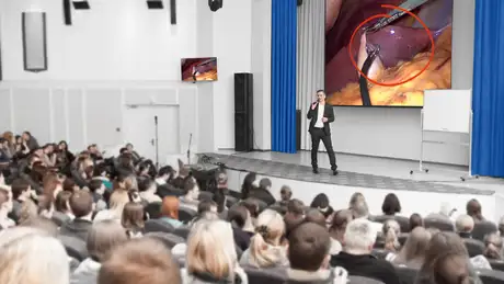 Speaker presenting surgical procedure to audience with medical image displayed on large screen.
