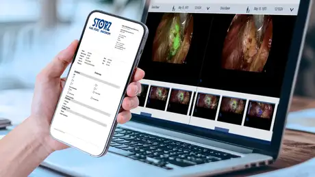 Hand holding a smartphone showing a medical report in front of a laptop displaying endoscopy images.