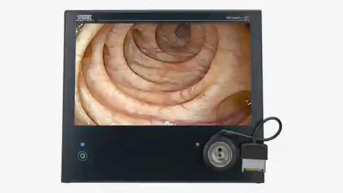 Endoscopic view of an intestinal tract displayed on a medical monitor screen.
