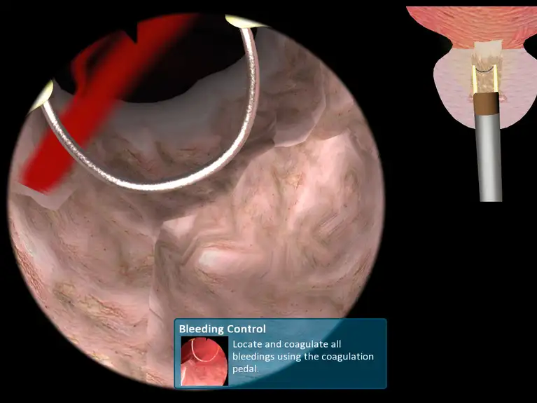 With a multifunctional platform, KARL STORZ now offers virtual reality simulators for gynecology, urology, and arthroscopy.