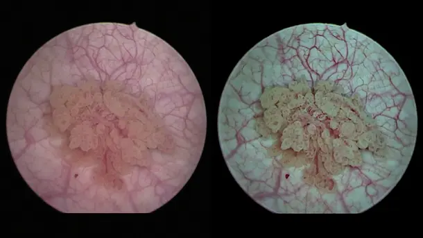 Close-up images of placental tissue showing blood vessels and villi under different lighting conditions.