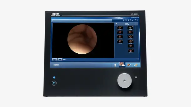 Medical endoscopy monitor displaying an internal body image with navigation buttons visible.