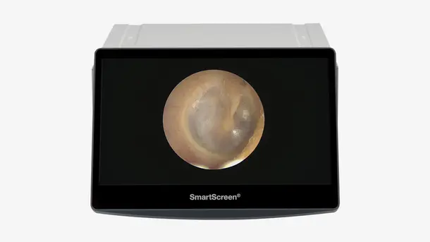 Close-up of a human eardrum displayed on a medical SmartScreen device.